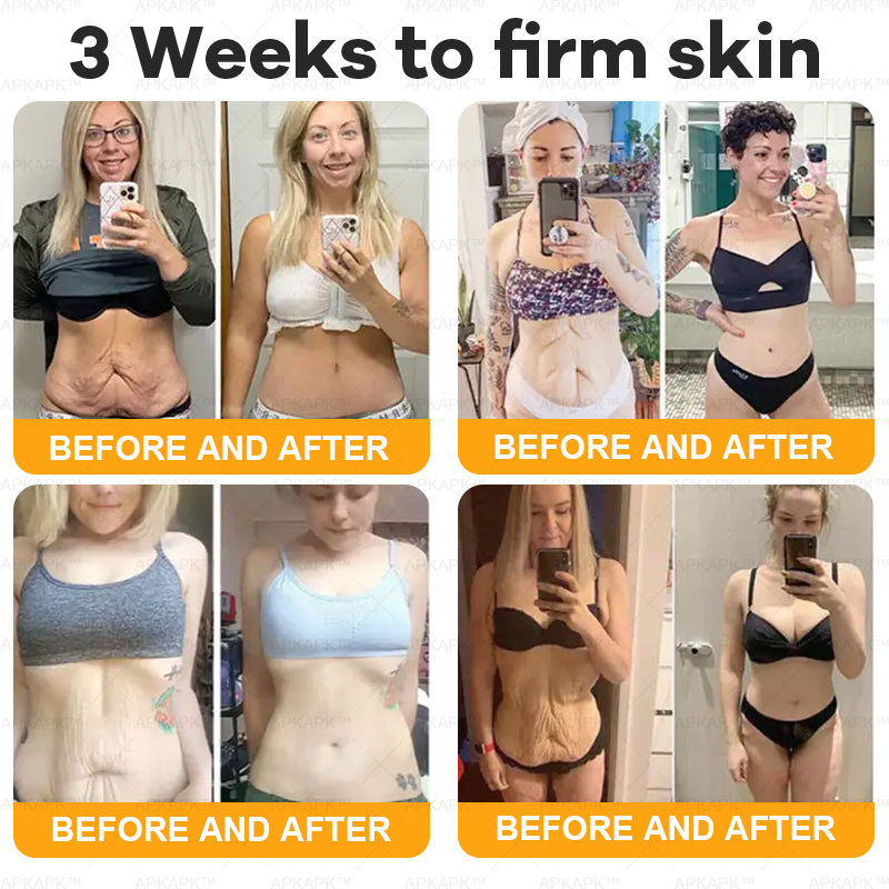 Bee Venom Comprehensive Cream | Anti-Aging, Firming & Hydrating for All Skin Types