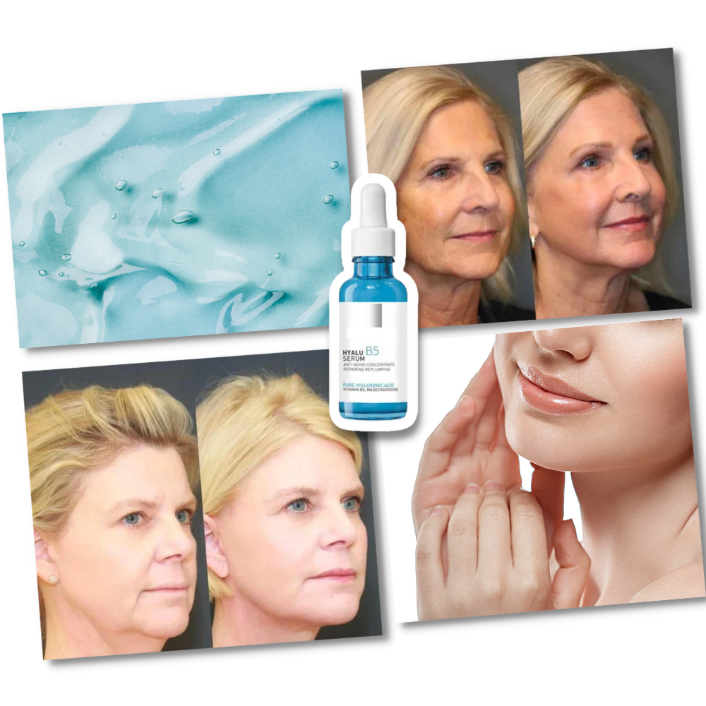 Rejuvenating Hyaluronic Acid Serum – Smooth Wrinkles & Lift Your Skin