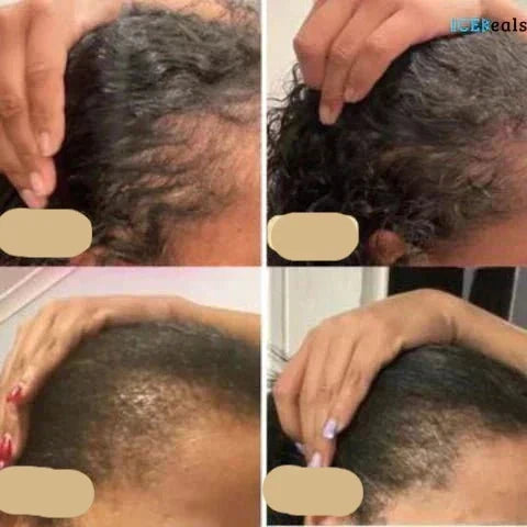 Natural Hair Growth Oil | 100% Organic, Strengthening Formula for All Hair Types