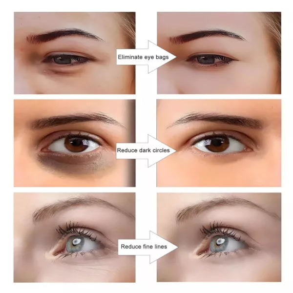 Red Light EMS Under Eye Massager | Anti-Aging, Collagen Boosting & Ideal for Skin Rejuvenation and Stress Relief