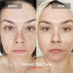 LED Face & Neck Rejuvenation Mask | 7-Color Phototherapy for Wrinkles, Acne & Youthful Skin