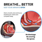 Premium Smart Anti-Snoring Device | EMS Sleep Tech & No-CPAP Relief
