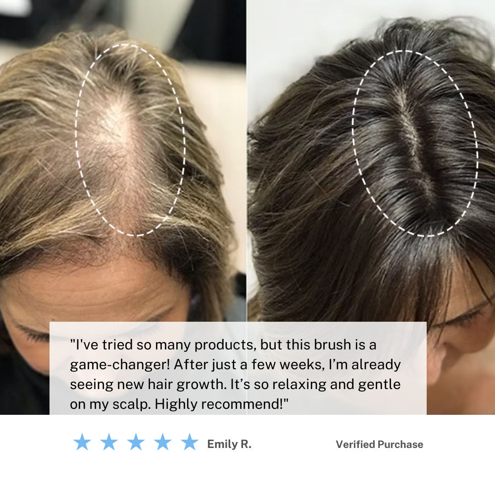 Electric Scalp Massager - Stimulating Brush with Red Light Therapy & Infrared Hair Wellness and Hair Growth