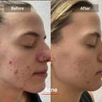 LED Face & Neck Rejuvenation Mask | 7-Color Phototherapy for Wrinkles, Acne & Youthful Skin