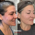 LED Face & Neck Rejuvenation Mask | 7-Color Phototherapy for Wrinkles, Acne & Youthful Skin