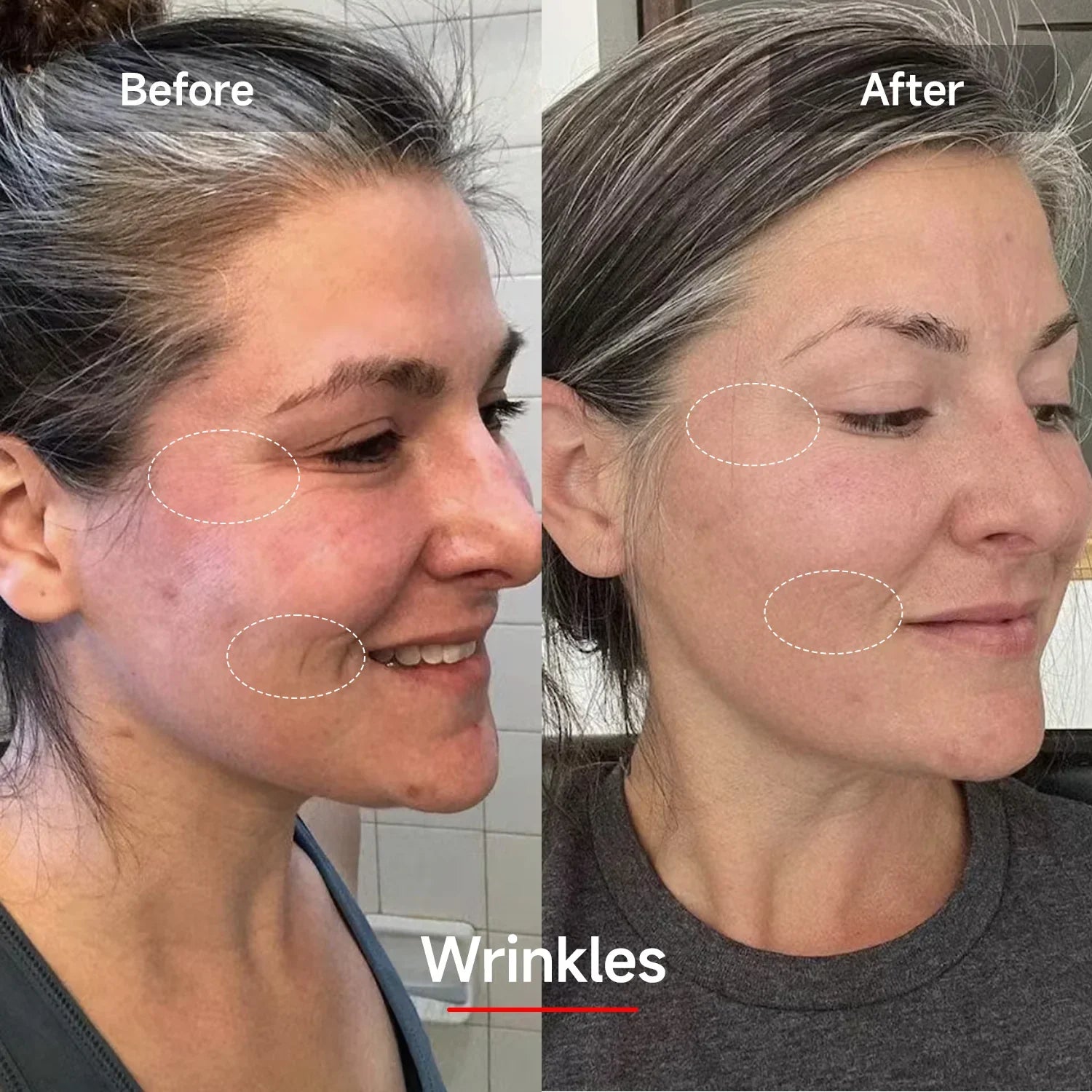 LED Face & Neck Rejuvenation Mask | 7-Color Phototherapy for Wrinkles, Acne & Youthful Skin