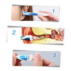 Ear Wax Remover - Smart Ear Pick Swab – Spiral Earwax Cleaner Tool for Safe and Easy Ear Cleaning