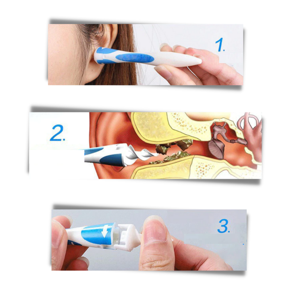 Ear Wax Remover - Smart Ear Pick Swab – Spiral Earwax Cleaner Tool for Safe and Easy Ear Cleaning