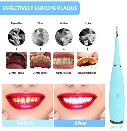Dental Calculus Remover | Effective Plaque & Tartar Cleaner for Home Oral Care