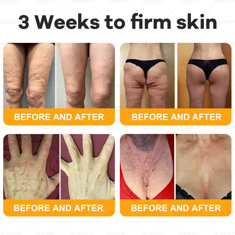 Bee Venom Comprehensive Cream | Anti-Aging, Firming & Hydrating for All Skin Types