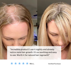 Electric Scalp Massager - Stimulating Brush with Red Light Therapy & Infrared Hair Wellness and Hair Growth