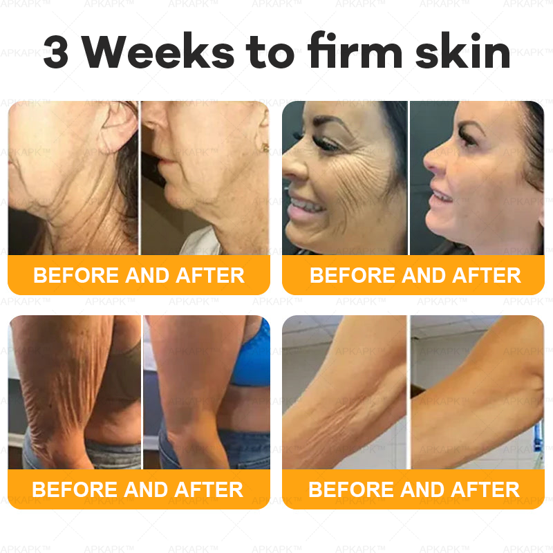 Bee Venom Comprehensive Cream | Anti-Aging, Firming & Hydrating for All Skin Types