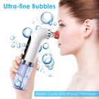 Hydrodermabrasion Facial Cleaner | Exfoliating, Vacuum & Deep Hydration for Clear, Youthful Skin