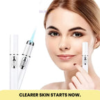 At-Home Blue Light Therapy Device | Non-Invasive Treatment for Spider & Varicose Veins, Portable & Rechargeable for Clearer Skin