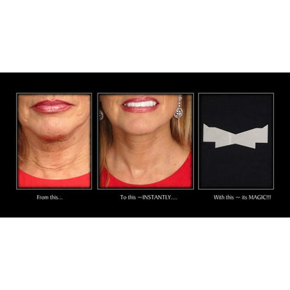 The Instant Neck Lift l No Pain Neck Lift Stretch Bands