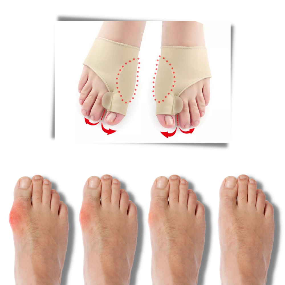 Gel Bunion Corrector | Soft Gel Toe Separator & Breathable Fabric for Pain Relief and Comfort with Shoes
