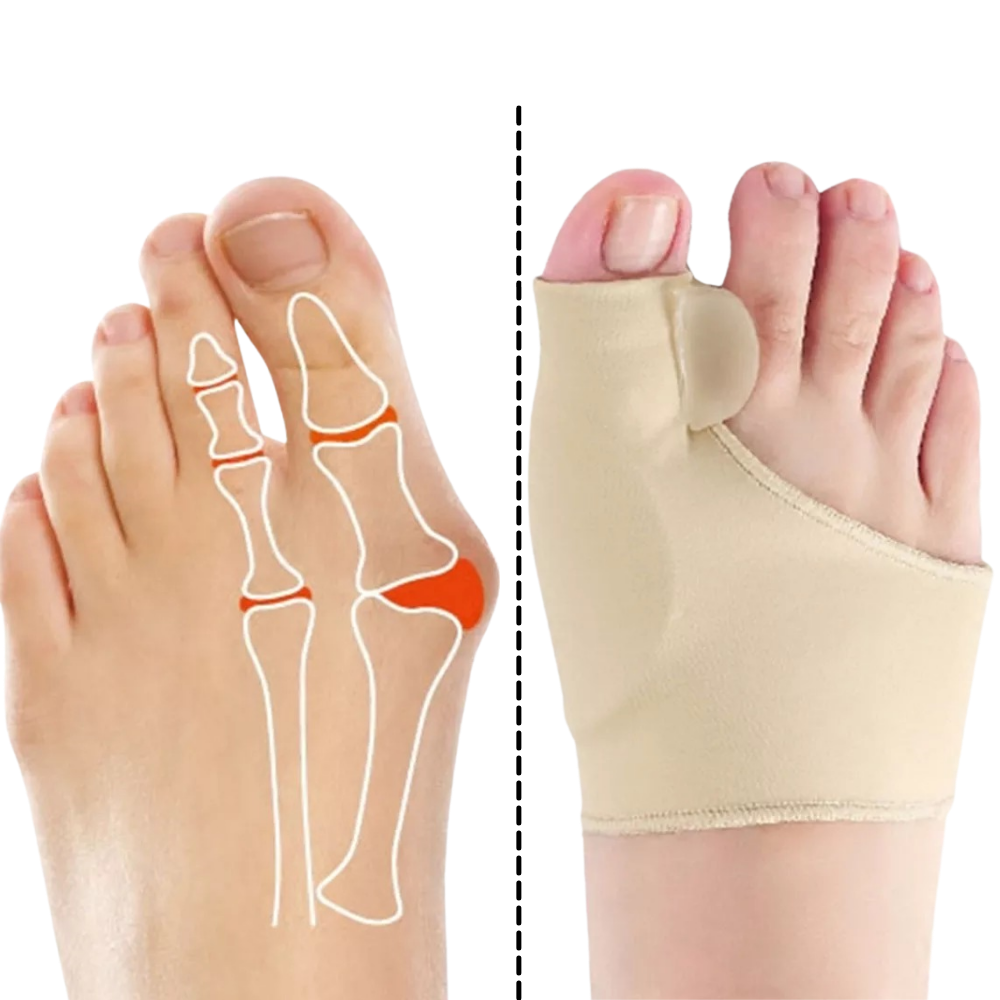 Gel Bunion Corrector | Soft Gel Toe Separator & Breathable Fabric for Pain Relief and Comfort with Shoes