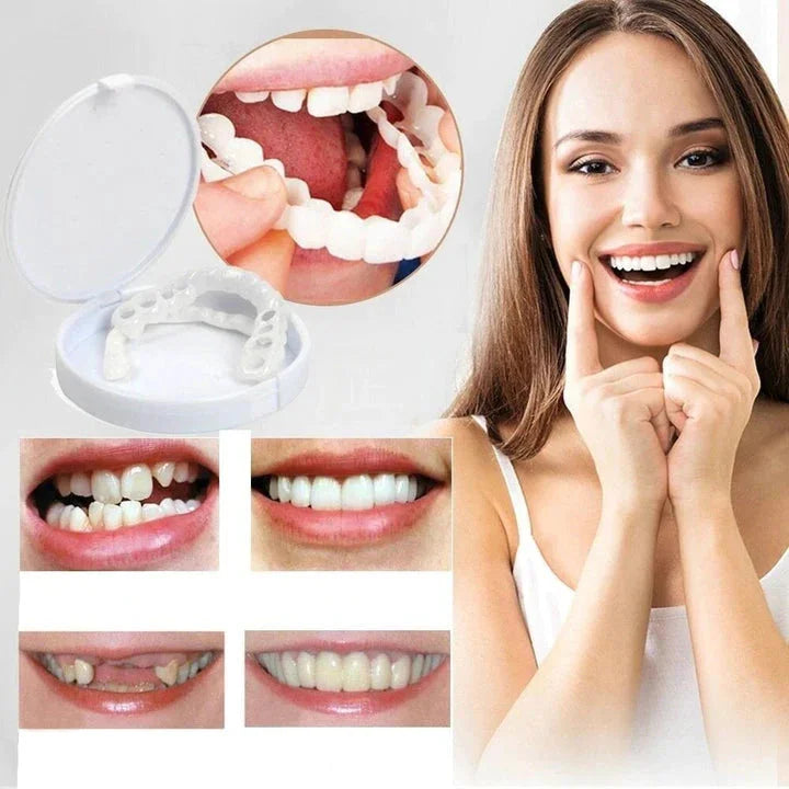 Snap-On Smile Veneers | Customizable, Easy-to-Use & Affordable Solution for Instant Smile Transformation