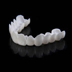 Snap-On Smile Veneers | Customizable, Easy-to-Use & Affordable Solution for Instant Smile Transformation