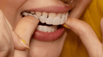 Snap-On Smile Veneers | Customizable, Easy-to-Use & Affordable Solution for Instant Smile Transformation