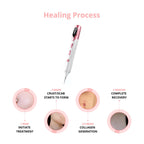 Skin Tag & Mole Remover Pen - Plasma Pen for Freckle, Skin Tag, Spot & Mole Removal