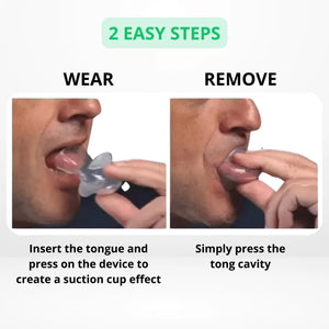 Tongue Retaining Device for Sleep Apnea – Anti-Snoring Aid, No CPAP Needed