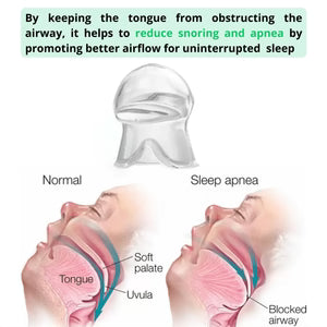 Tongue Retaining Device for Sleep Apnea & Snoring | Comfortable, CPAP-Free Relief