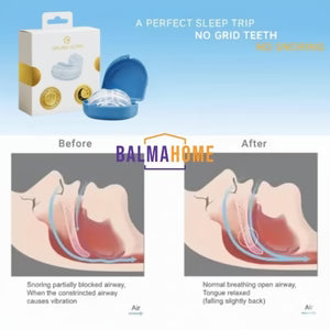 Sleep Apnea Oral Appliance | Affordable CPAP Alternative for Snoring Relief