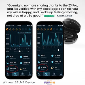 Premium Smart Anti-Snoring Device | EMS Sleep Tech & No-CPAP Relief
