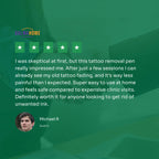 Tattoo Removal Laser Pen | Safe, Effective Blue Light Therapy for At-Home Ink Fading and Skin Confidence