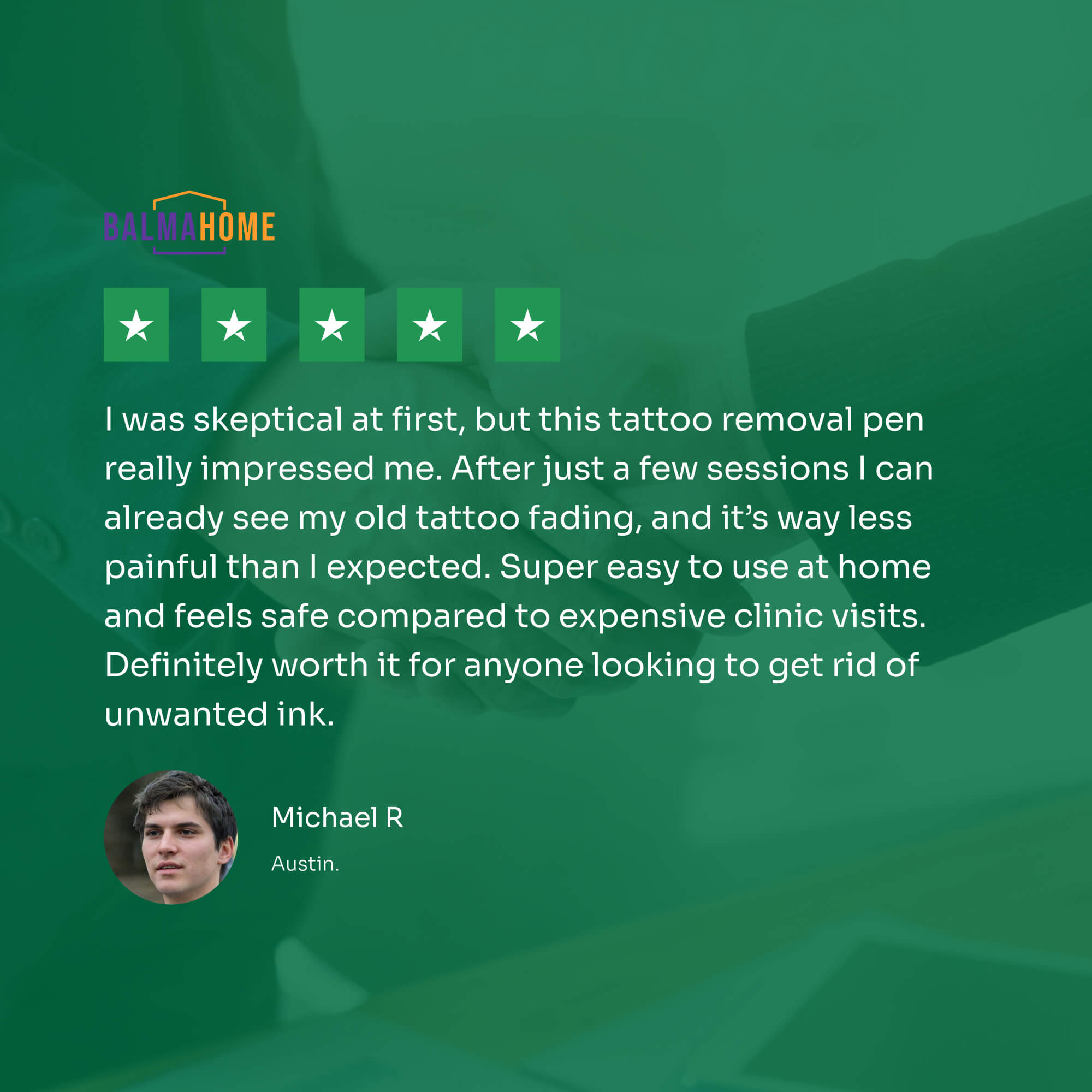 Tattoo Removal Laser Pen | Safe, Effective Blue Light Therapy for At-Home Ink Fading and Skin Confidence