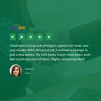 Blue Light Therapy Laser Pen | Acne, Dark Spot & Spider Vein Treatment for Safe At-Home Skin Care