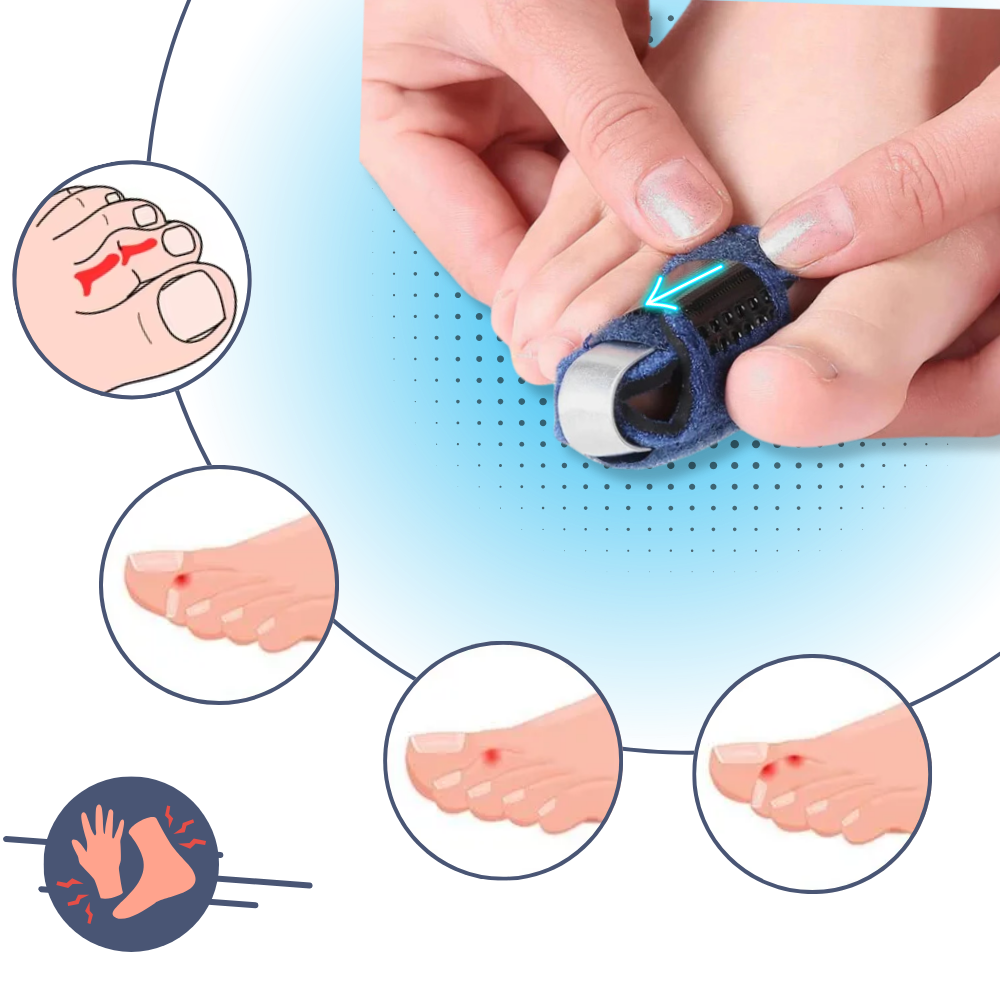 Adjustable Toe Straightener | Breathable, Lightweight Aluminum Support for Hammer Toe Relief and Enhanced Alignment