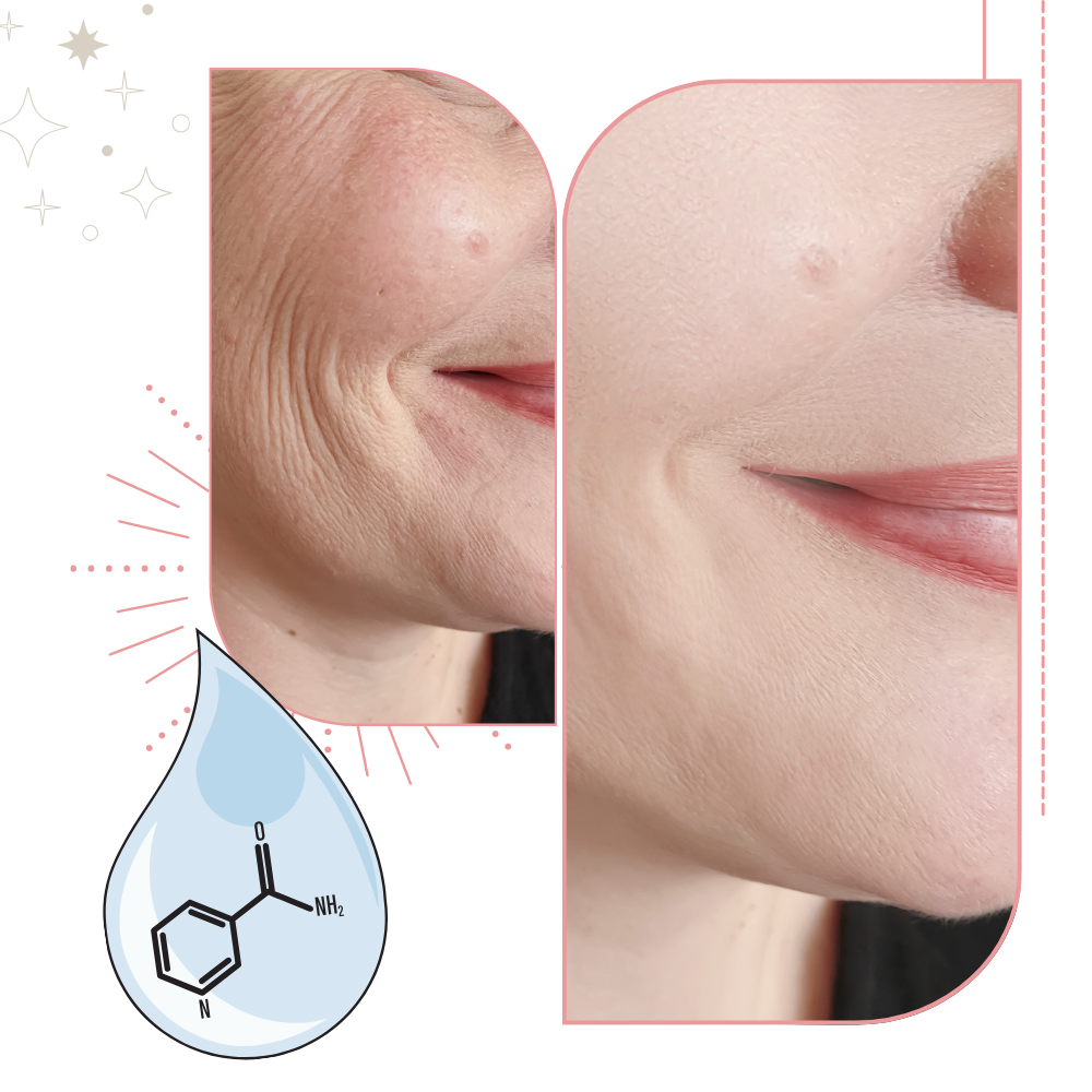 Anti-Wrinkle Skin Cream – Advanced Firming Formula for Smooth, Youthful Skin