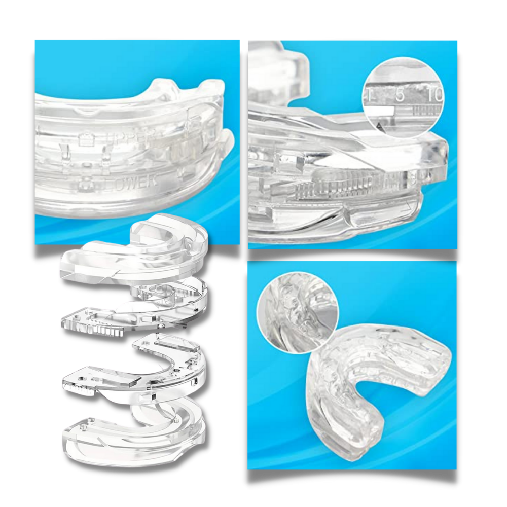 Advanced Anti-Snoring Device | Comfortable, Non-Invasive Design for Better Sleep Quality