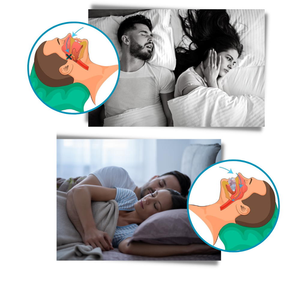 Anti-Snore Mouthpiece – Sleep Apnea Solution & Snoring Aid for Restful Nights