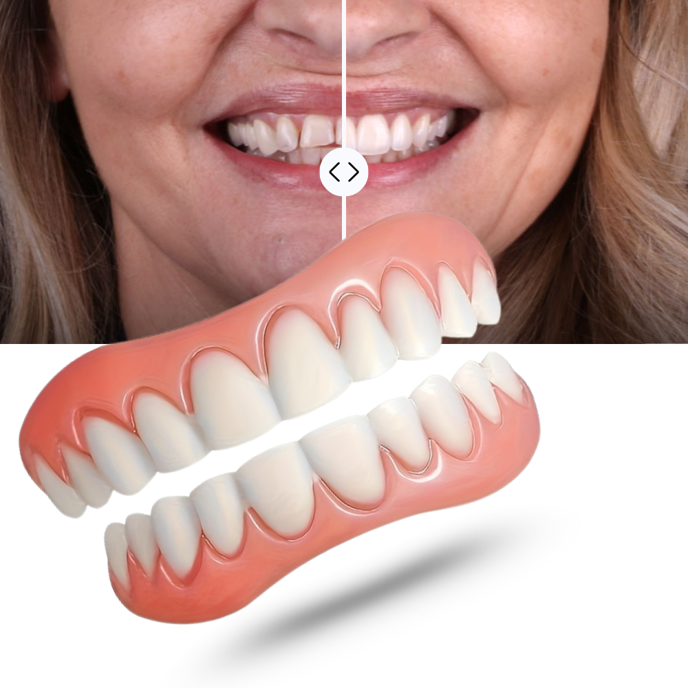 CustomGrip Denture Solution | Customizable Fit, Strong Adhesive & Easy Maintenance for Natural Smile Enhancement