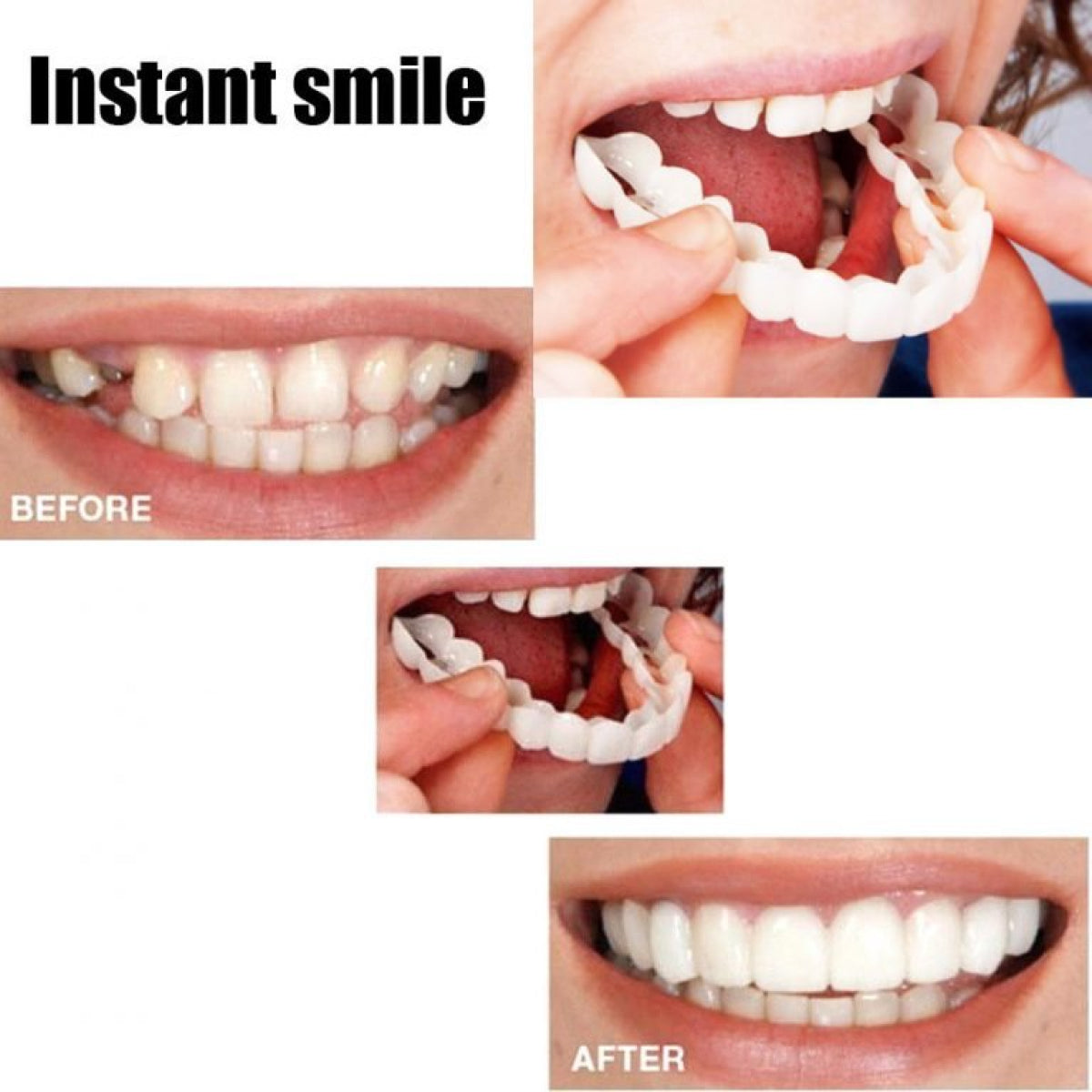 Instant Perfect Smile Upper and Lower Clip/Snap On Veneers for Perfect Teeth