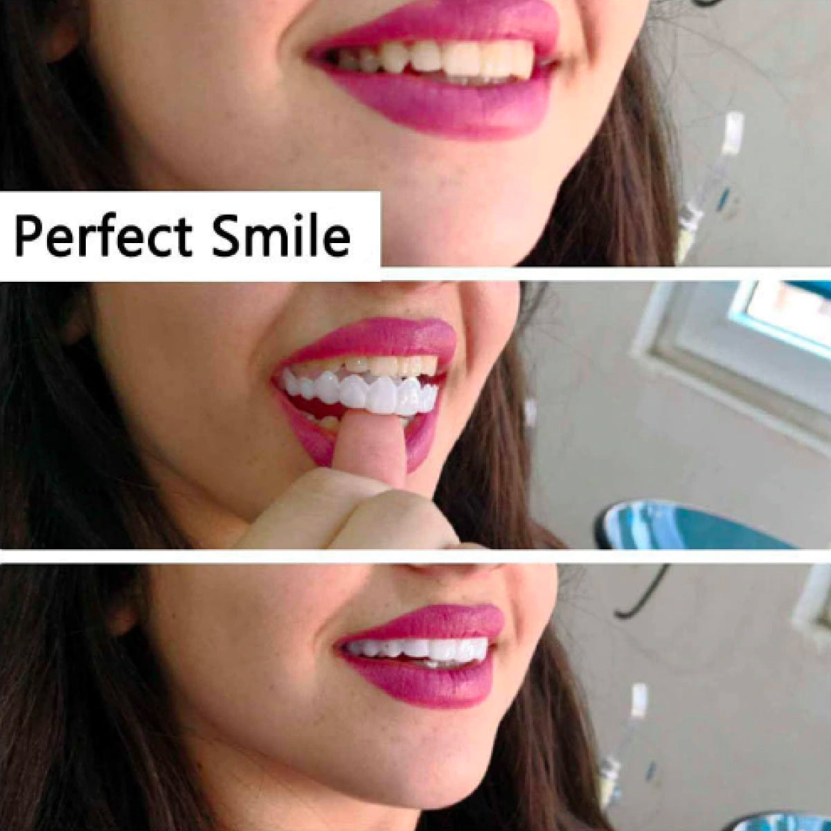 Instant Perfect Smile Upper and Lower Clip/Snap On Veneers for Perfect Teeth
