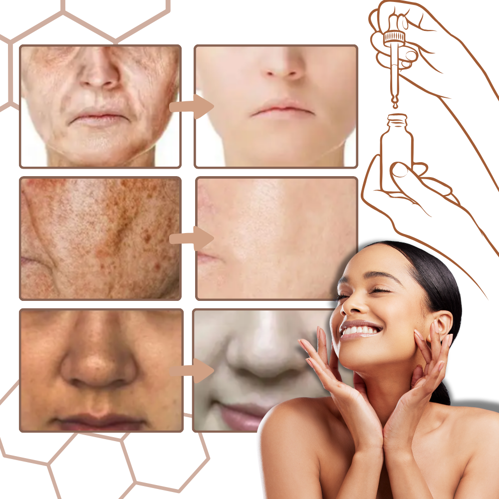 Non-Greasy Melanin Correcting Facial Serum | Hydrating, Quick Absorption & Reduces Hyperpigmentation for Brighter Skin