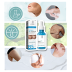 Rejuvenating Hyaluronic Acid Serum – Smooth Wrinkles & Lift Your Skin