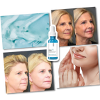 Rejuvenating Hyaluronic Acid Serum – Smooth Wrinkles & Lift Your Skin